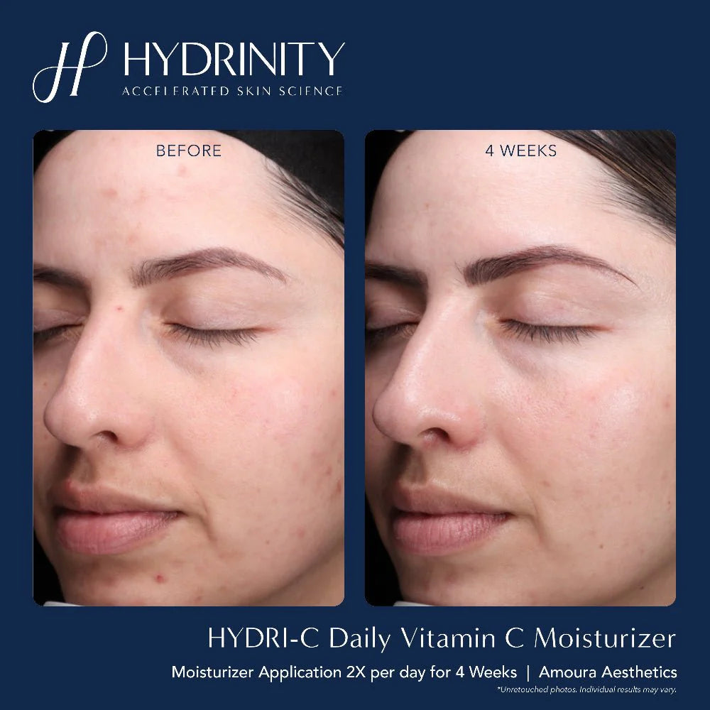 Hydrinity- Hydri-C Daily Vitamin C Moisturizer