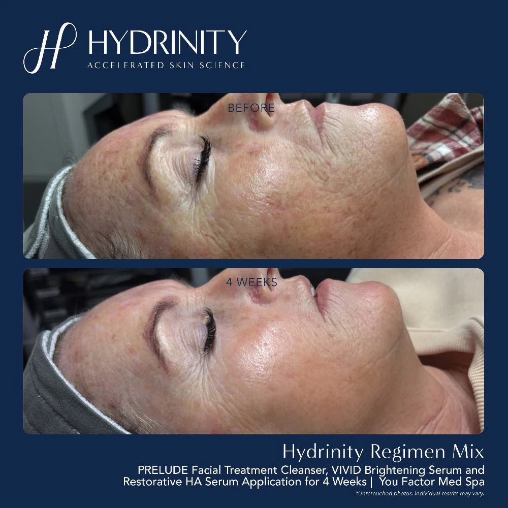 Hydrinity- Prelude Facial Treatment Cleanser