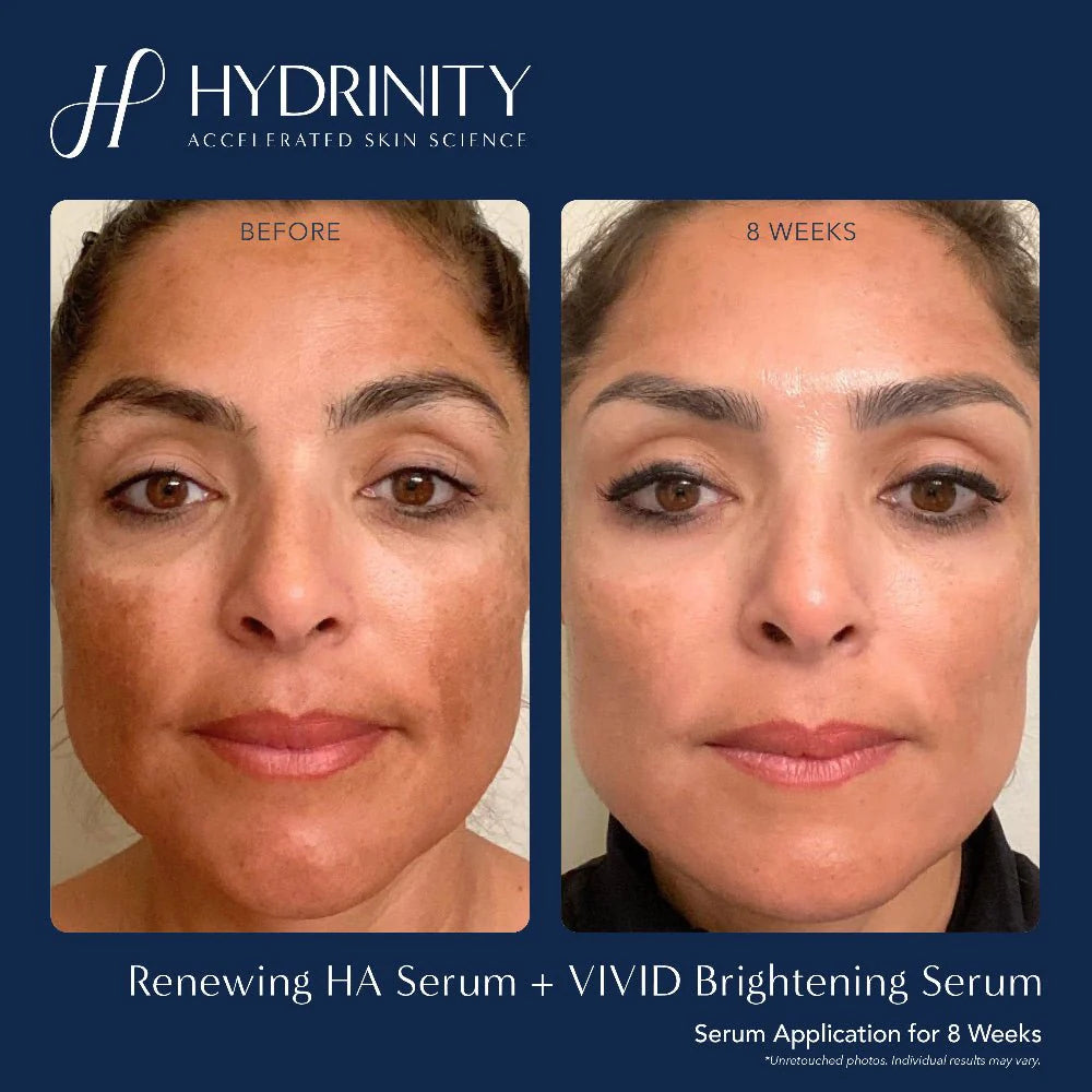 Hydrinity - Vivid Brightening Serum